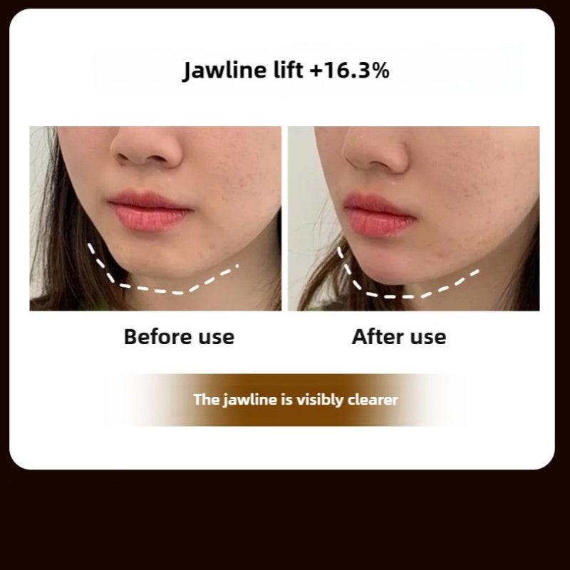 3D Microcurrent Face Lifting Massager Roller – Skin Tightening & Facial Rejuvenation Device