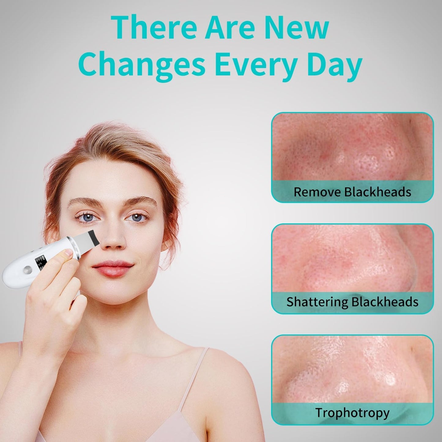 4-in-1 Ultrasonic Skin Spatula Face Scrubber – Deep Pore Blackhead Remover (White)