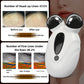 3D Microcurrent Face Lifting Massager Roller – Skin Tightening & Facial Rejuvenation Device
