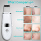 4-in-1 Ultrasonic Skin Spatula Face Scrubber – Deep Pore Blackhead Remover (White)