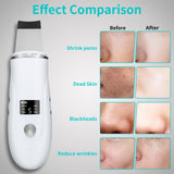 4-in-1 Ultrasonic Skin Spatula Face Scrubber – Deep Pore Blackhead Remover (White)